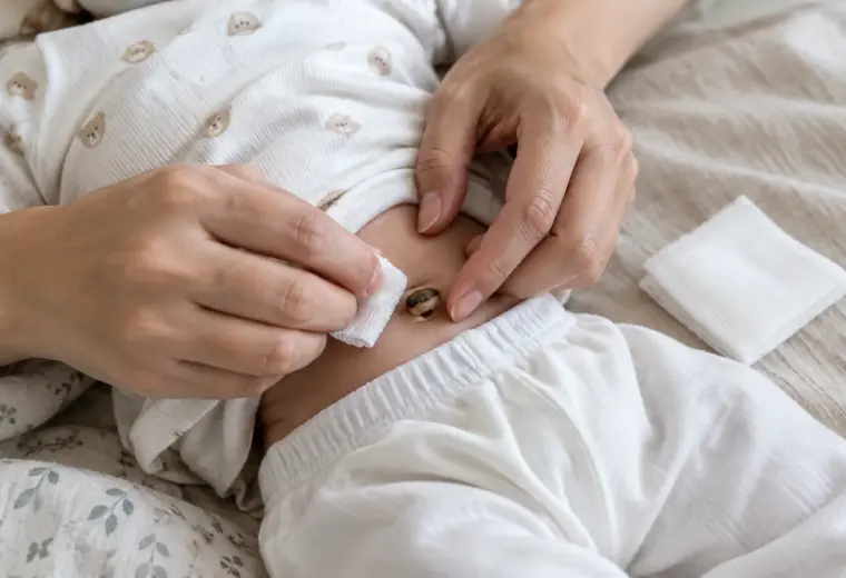 Mains d’un parent qui prend soin délicatement du nombril d’un nouveau-né.
