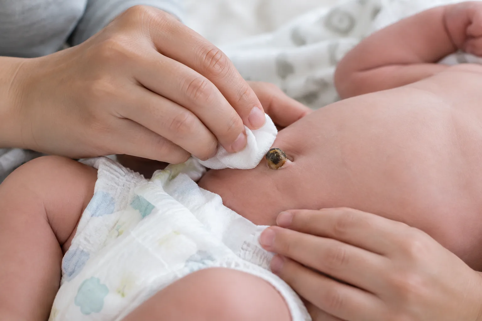 Un parent nettoie délicatement autour du cordon ombilical de bébé avec une compresse propre.